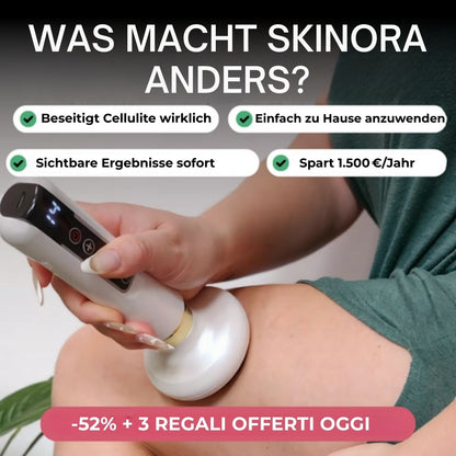 Skinora™ - Anti-Cellulite-Massagegerät + 3 Geschenke